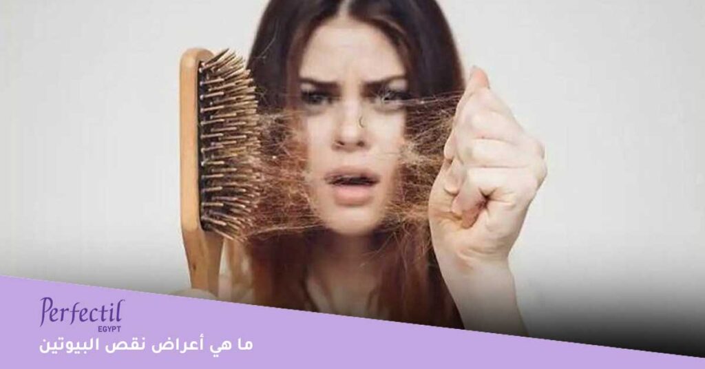 ما-هي-أعراض-نقص-البيوتين