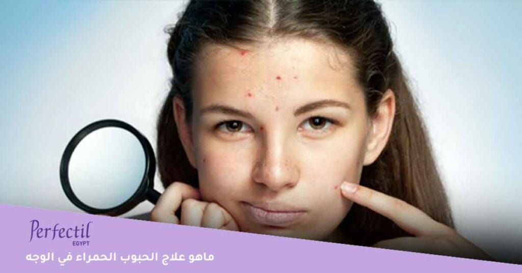 ماهو علاج الحبوب الحمراء في الوجه 