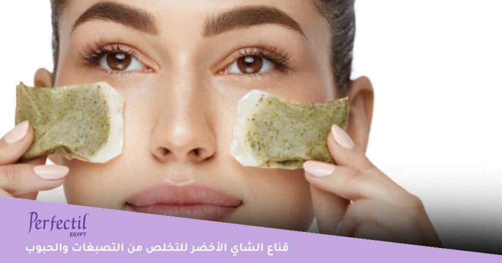 قناع الشاي الأخضر للتخلص من التصبغات والحبوب