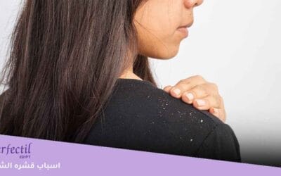اسباب قشره الشعر .. 3 وصفات طبيعية للتخلص من القشرة للحفاظ على أناقة ملابس الشتاء؟