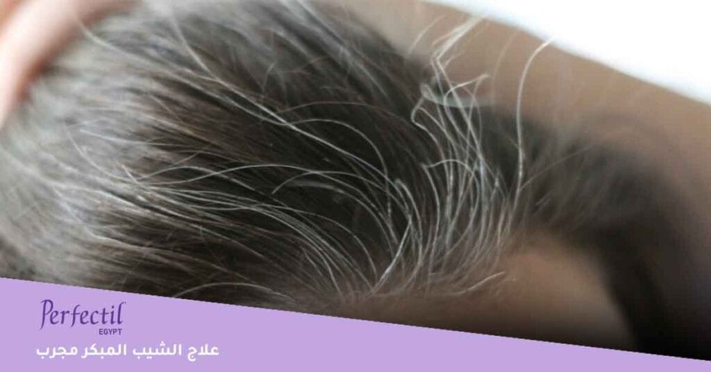 علاج الشيب المبكر مجرب