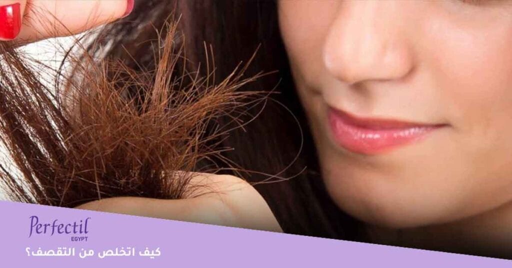 كيف اتخلص من التقصف؟