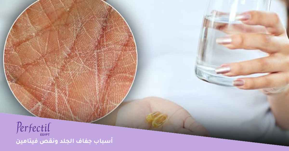 أسباب جفاف الجلد ونقص فيتامين