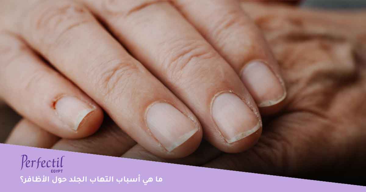 أسباب التهاب الجلد حول الأظافر-العناية بالاظافر-علاج الزوائد الجلدية في الأصابع-تشقق حول الاظافر-الاهتمام بالاظافر-الاعتناء بالاظافر وتطويلها-التخلص من السواد حول الاظافر