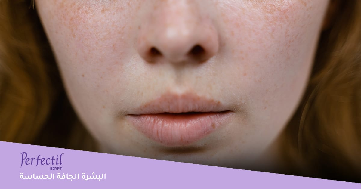 البشرة الجافة الحساسة