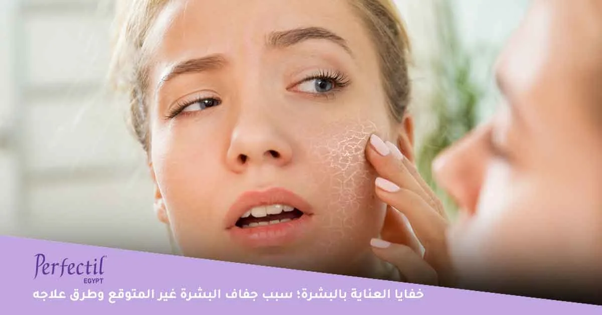 خفايا العناية بالبشرة:سبب جفاف البشرة غير المتوقع وطرق علاجه