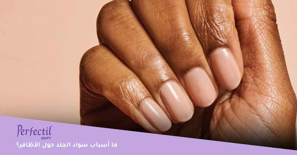 علاج الخطوط الطولية في الأظافر-العناية بالاظافر-تقليم الأظافر-إزالة الجلد الميت من الأظافر-اسباب اسمرار الجلد حول الاظافر-اسباب التقشير حول الاظافر-اعتناء بالاظافر
