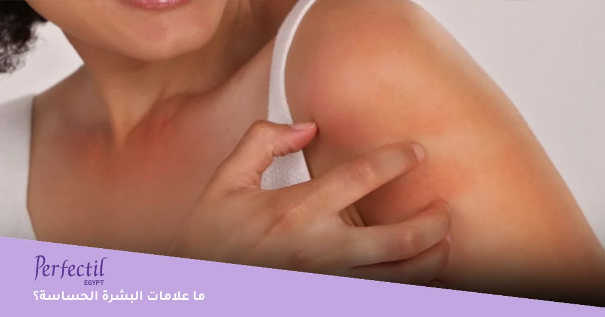 ما علامات البشرة الحساسة؟