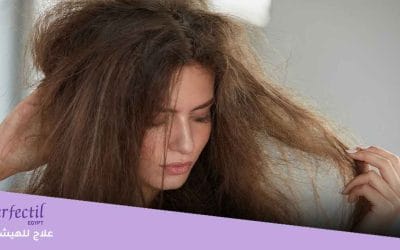 أسرع علاج للهيشان والتقصف في الصيف خلال يومًا واحدًا