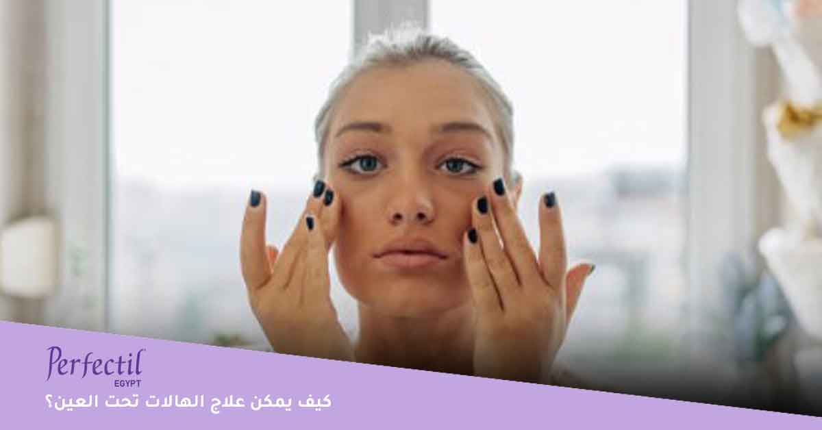 كيف يمكن علاج الهالات تحت العين؟