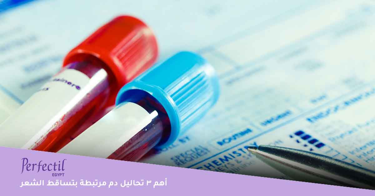 أهم 3 تحاليل دم مرتبطة بتساقط الشعر