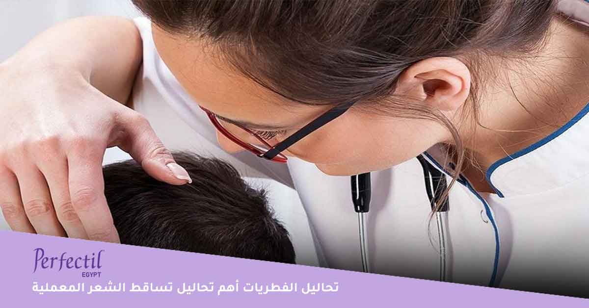 أهم تحاليل تساقط الشعر المعملية