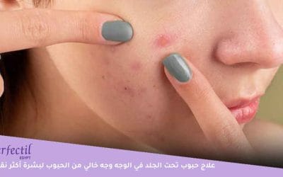 علاج حبوب تحت الجلد في الوجه لبشرة أكثر نقاءًا وجمالًا طبيعيًا