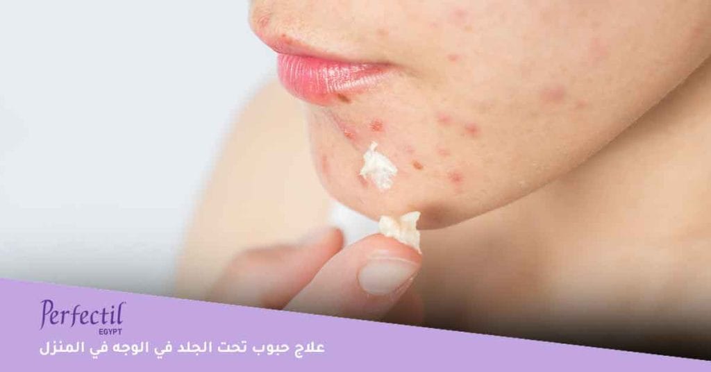 علاج حبوب تحت الجلد في الوجه في المنزل أنواع حبوب الوجه المختلفة 