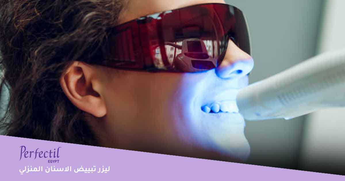 ليزر تبييض الاسنان المنزلي-أفضل جهاز تبييض الأسنان المنزلي 