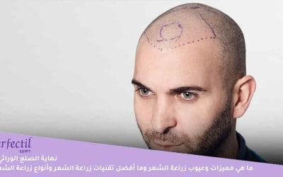 نهاية الصلع الوراثي | ما هي مميزات وعيوب زراعة الشعر وما أفضل تقنيات زراعة الشعر وأنواع زراعة الشعر؟